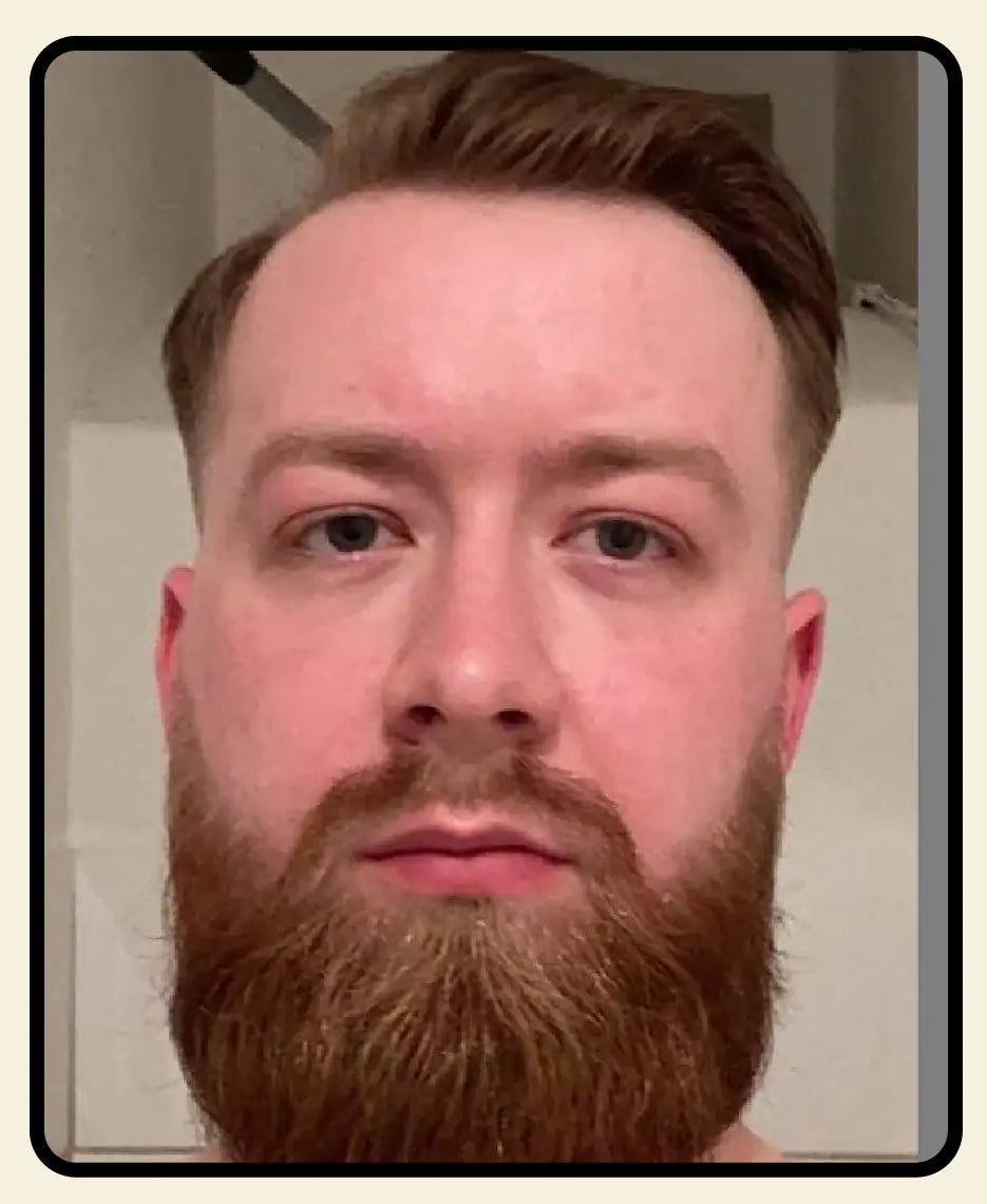 SERUM GROWTH BEARD [PV1-META-ELITEZONEMARKET]