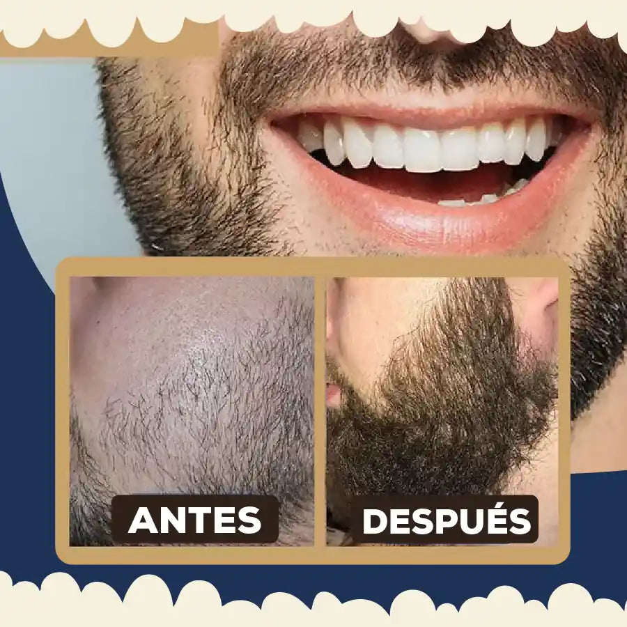 SERUM GROWTH BEARD [PV1-META-ELITEZONEMARKET]